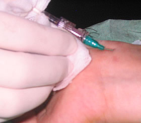 Catéteres arteriales