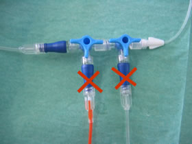 Equipos, llaves de tres vías y puntos de inyección de los sistemas de infusión