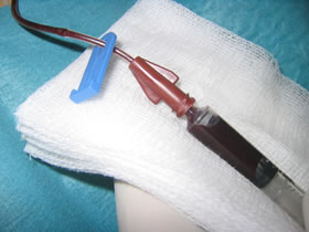 Posición y colocación segura durante la inserción del catéter